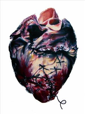 How Is Your Heart Today?