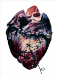 How Is Your Heart Today?