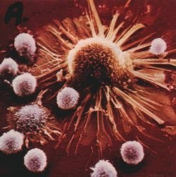 Which Disease Is Most Like You?