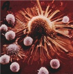 Which Disease Is Most Like You?