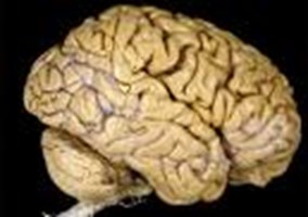 Do You Have A Brain?