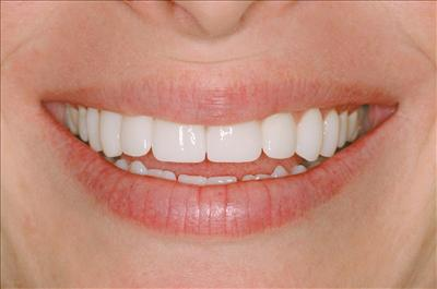How Is Your Dental History Knowledge