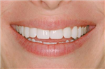 How Is Your Dental History Knowledge