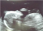 Baby Girl Wallace