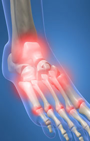 Your Body Area Most Susceptible To Injury