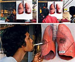 Anti-Smoking