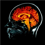 Test Intelligence