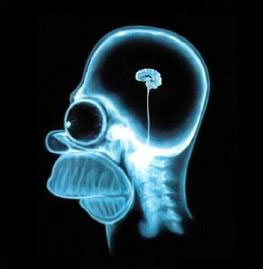 Intelligent Ou Imbécile