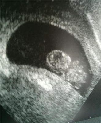 Baby Brown Gender Poll