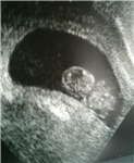 Baby Brown Gender Poll
