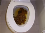 Poo