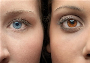 Quel Type De Yeux Vous Avez