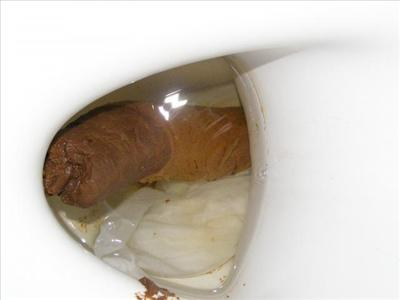Hovno Or Sračka
