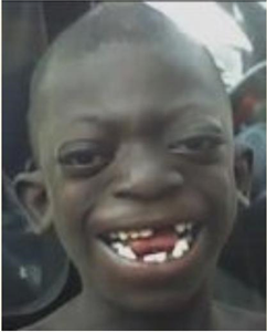 Eres Negro 2 ?