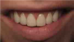 Dentcmu เหงือกคุณแค่ไหน
