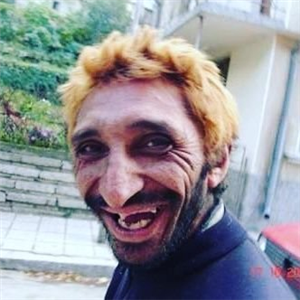 Salak Mısın?