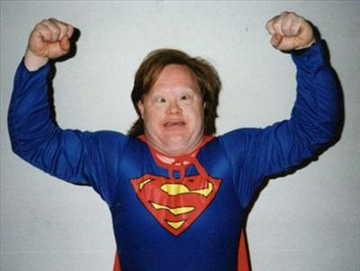 Are You A Super Retard?