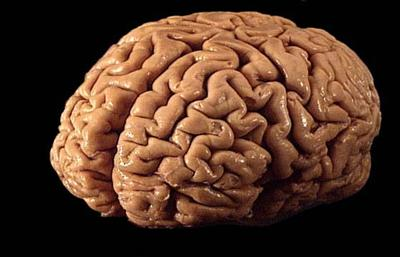 Are You Smart Today?