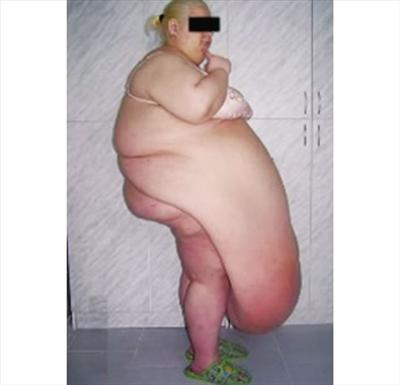 How Fat Are You