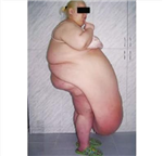 How Fat Are You